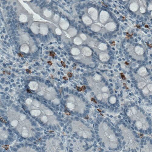 Staining of human small intestine shows strong immunoreactivity in a subset of lymphoid cells (macrophages).