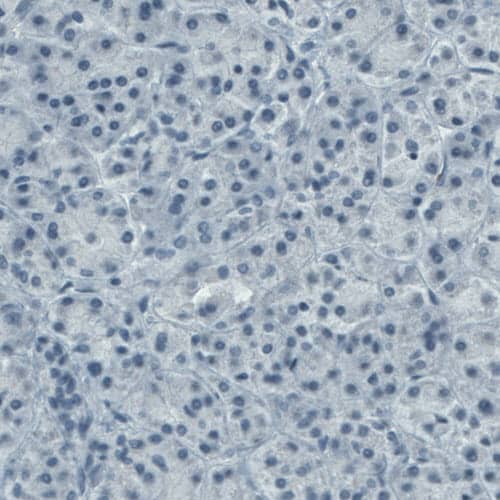 Staining of human pancreas shows absence of immunoreactivity (negative control).