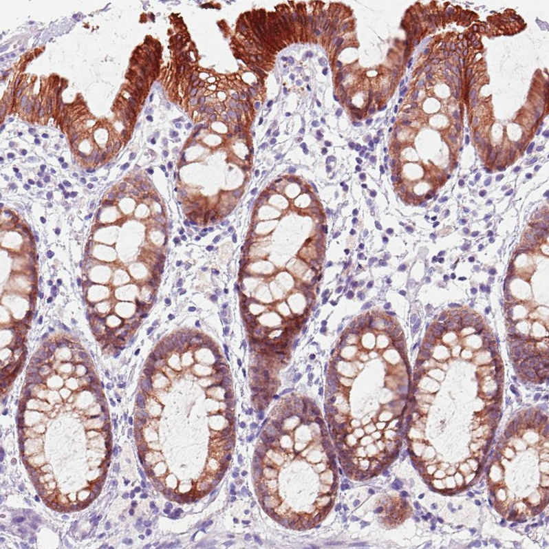 Staining of human colon shows strong membranous positivity in glandular cells.