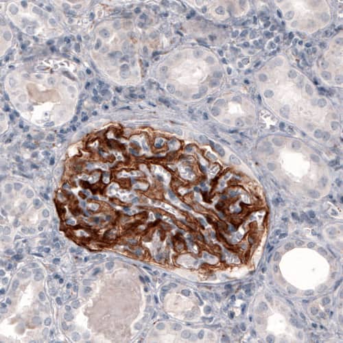 Staining of human kidney shows strong positivity in renal glomerulus.