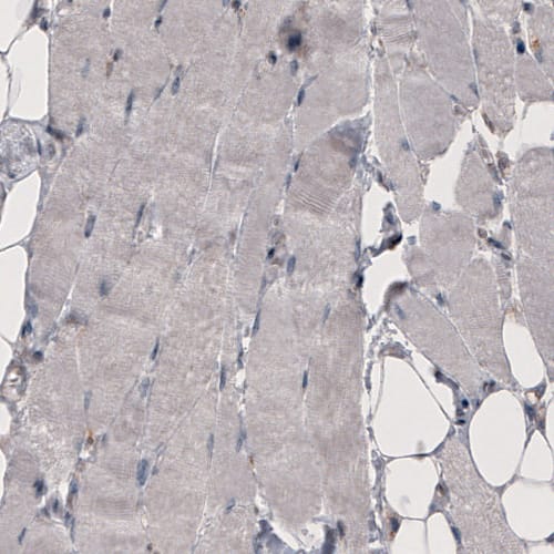Staining of human skeletal muscle shows absence of immunoreactivity (negative control).