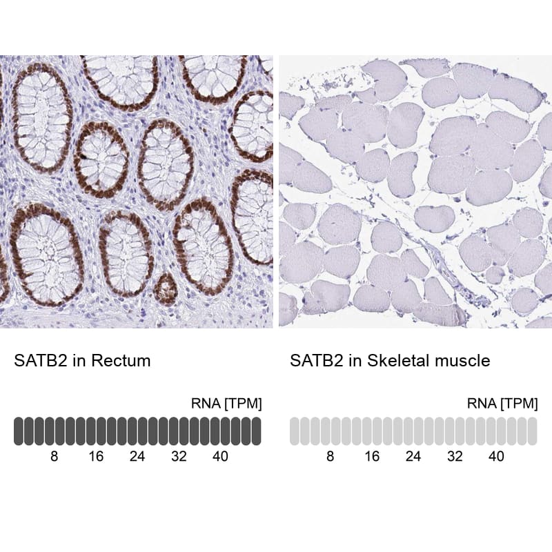 Analysis in human rectum and skeletal muscle tissues using NBP3-44079 antibody. Corresponding SATB2 RNA-seq data are presented for the same tissues.