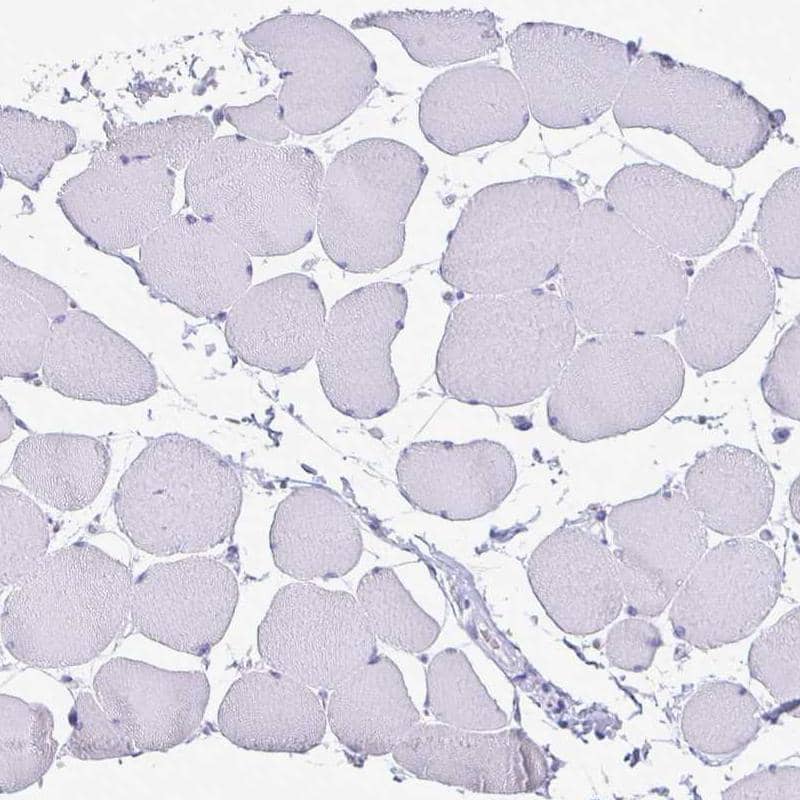 Staining of human skeletal muscle shows no positivity in striated muscle fibers, as expected.