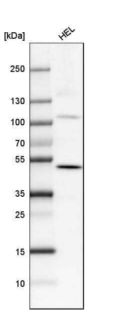 Analysis in human cell line HEL.