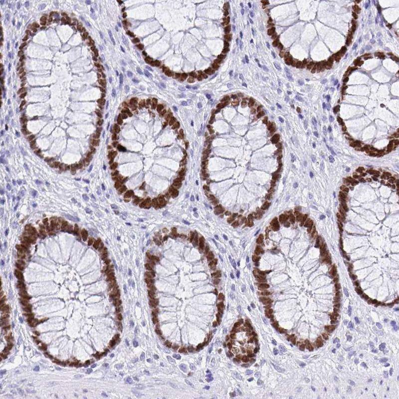 Staining of human rectum shows strong nuclear positivity in glandular cells.