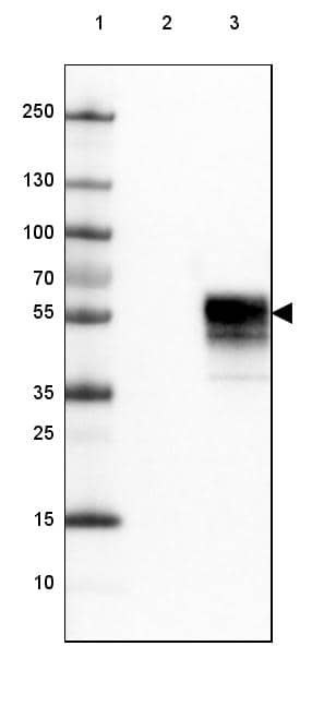 Lane 1: Marker [kDa] 250) Lane 3: Over-expression lysate (Co-expressed with a C-terminal myc-DDK tag in mammalian HEK293T cells)