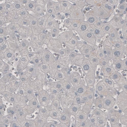 Staining of human liver shows absence of immunoreactivity (negative control).