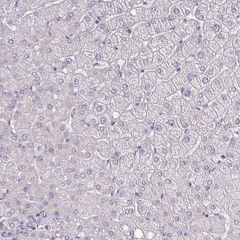 Staining of human liver shows no positivity in hepatocytes as expected.