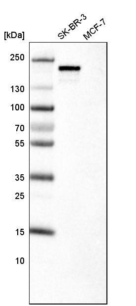 Analysis in human cell line SK-BR-3 and human cell line MCF-7.