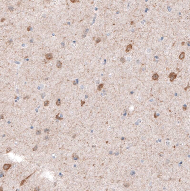 Staining of human cerebral cortex shows moderate cytoplasmic positivity in neurons.