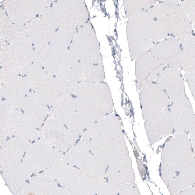 Staining of human skeletal muscle shows no positivity as expected.