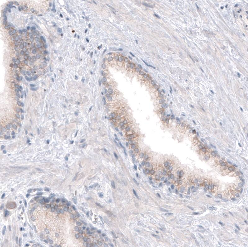 Staining of human prostate shows weak cytoplasmic positivity in glandular cells.