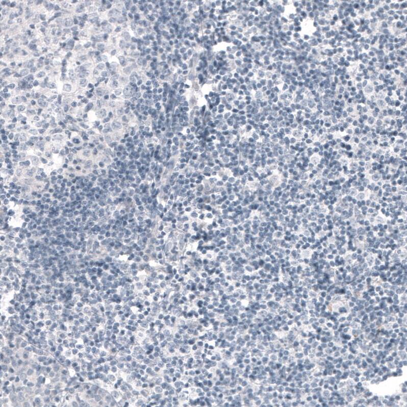 Staining of human tonsil shows no positivity in lymphoid cells as expected.