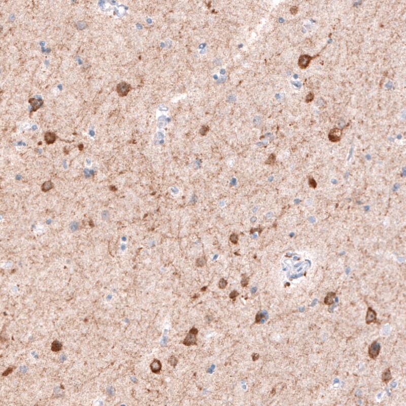 Staining of cerebral cortex shows strong cytoplasmic immunoreactivity in neurons.