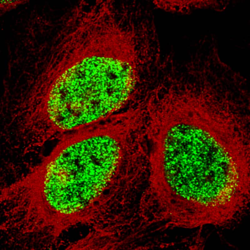 Staining of U-2 OS cells using the Anti-SMCHD1 monoclonal antibody) .
