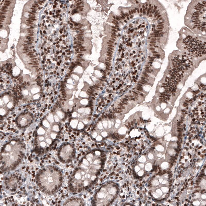 Staining of human small intestine shows strong nuclear immunoreactivity in glandular cells and in connective tissue cells.
