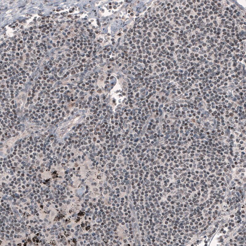 Staining of human lymph node shows weak to moderate nuclear immunoreactivity in lymphoid cells.