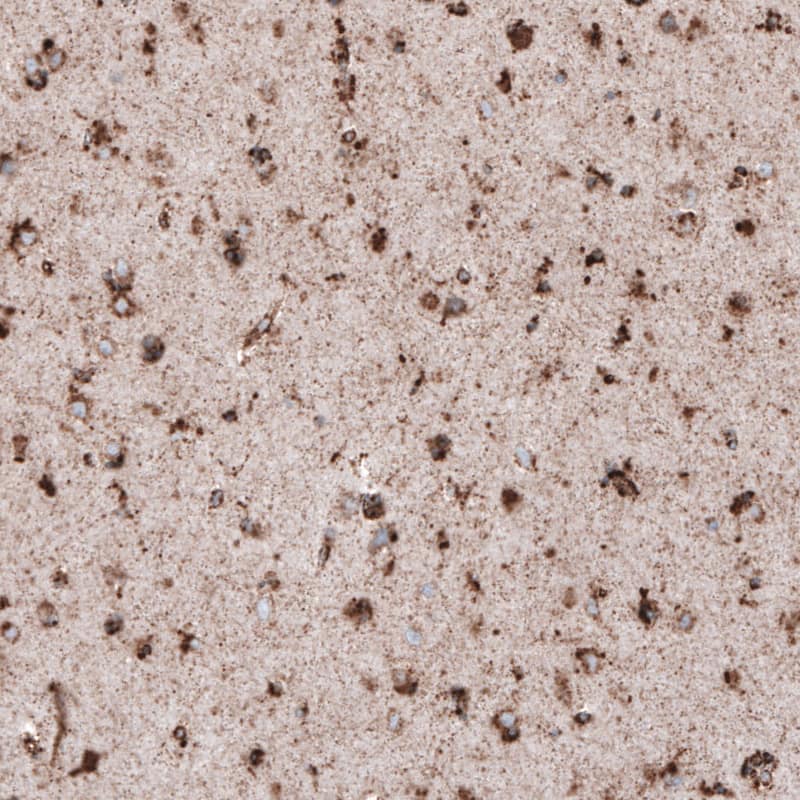 Staining of human cerebral cortex shows strong granular cytoplasmic positivity in neuronal cells.