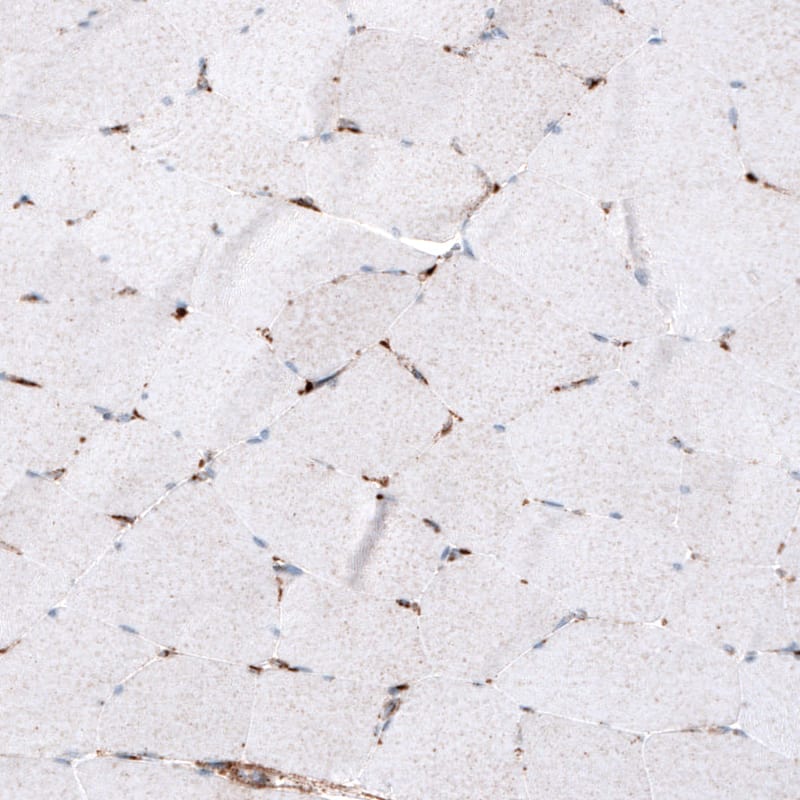 Staining of human skeletal muscle shows only weak cytoplasmic positivity in muscle fibers.