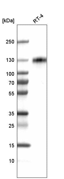 Analysis in human cell line RT-4.