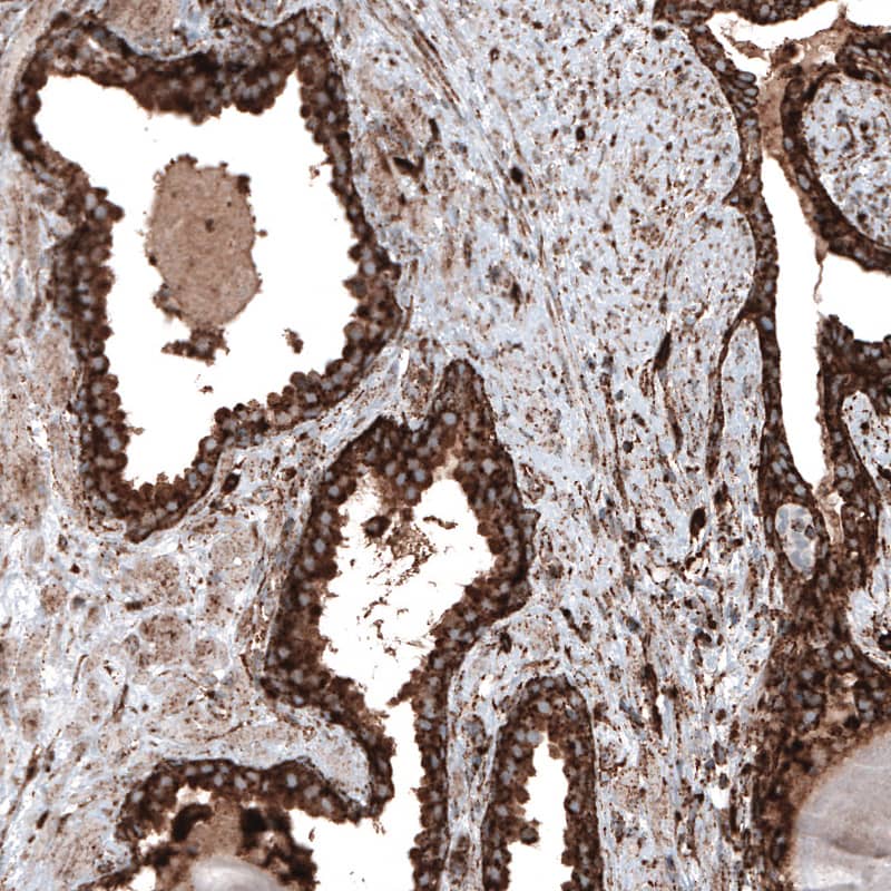 Staining of human prostate shows strong cytoplasmic positivity in glandular cells.
