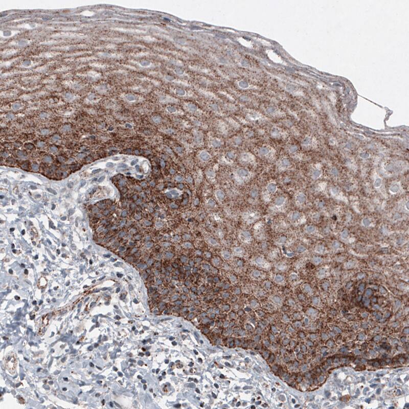 Staining of human cervix shows granular cytoplasmic immunoreactivity in squamous epithelium cells.