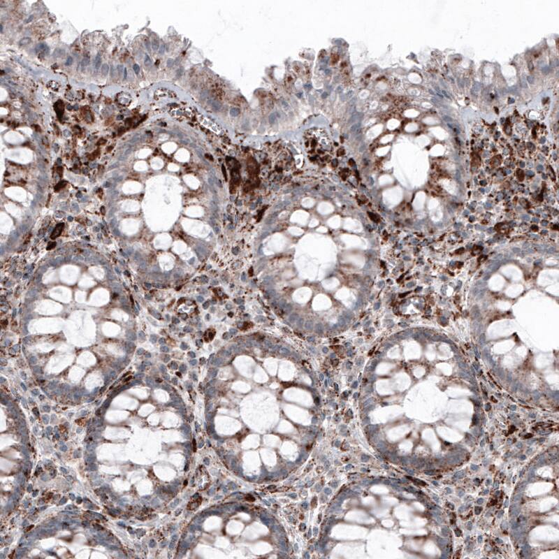 Staining of human rectum shows granular cytoplasmic immunoreactivity in glandular cells and in lymphoid cells.