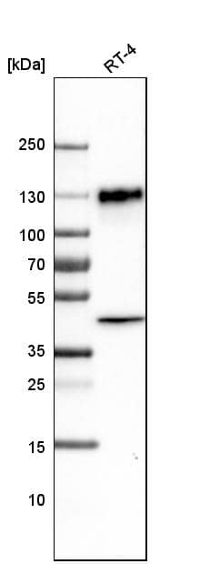 Analysis in human cell line RT-4.