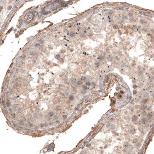 Staining of human testis shows centrosome-like immunoreactivity in a subset of seminiferous epithelium cells.