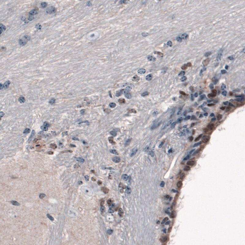 Staining of mouse forebrain shows moderate nuclear immunoreactivity in a subset of cells in the lateral ventricle wall.
