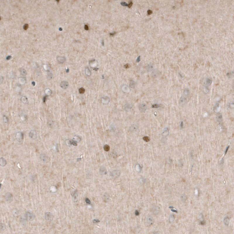 Staining of mouse cerebral cortex shows nuclear positivity in a subset of cells.