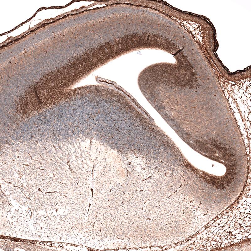 Staining of mouse embryo E14 shows nuclear immunoreactivity in the developing forebrain.