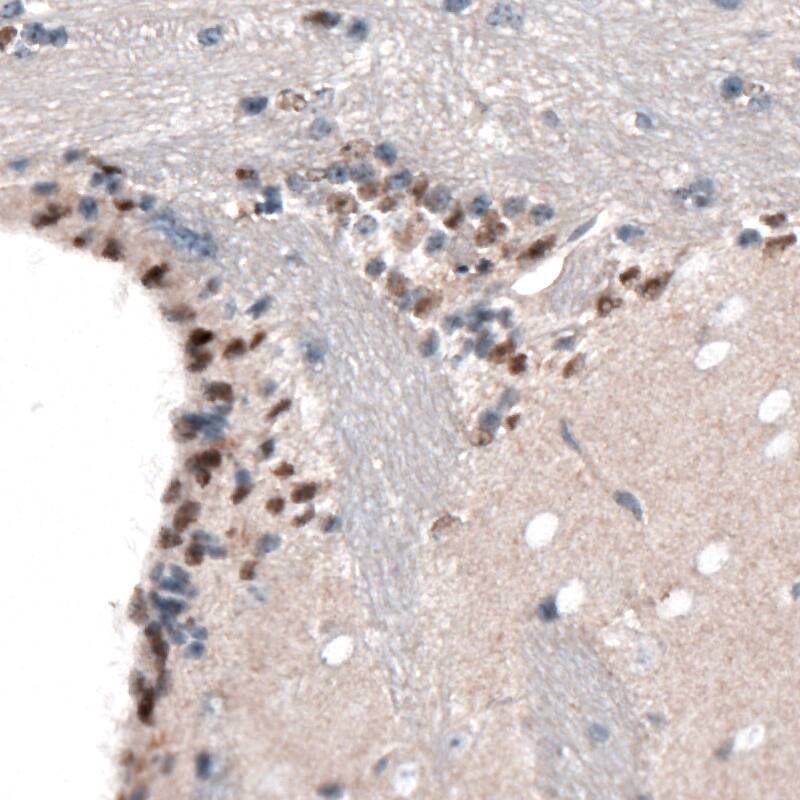 Staining of mouse forebrain shows nuclear immunoreactivity in a subset of cells in the lateral ventricle wall.