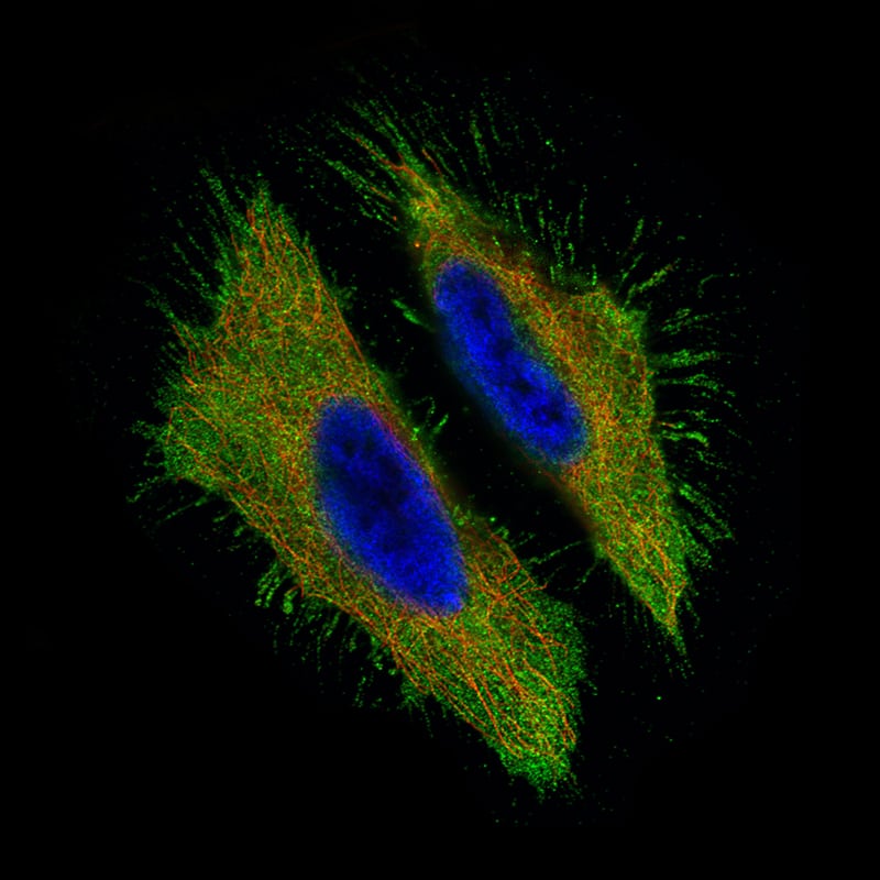 Staining of HeLa cells using the Anti-CA125/MUC16 monoclonal antibody) .