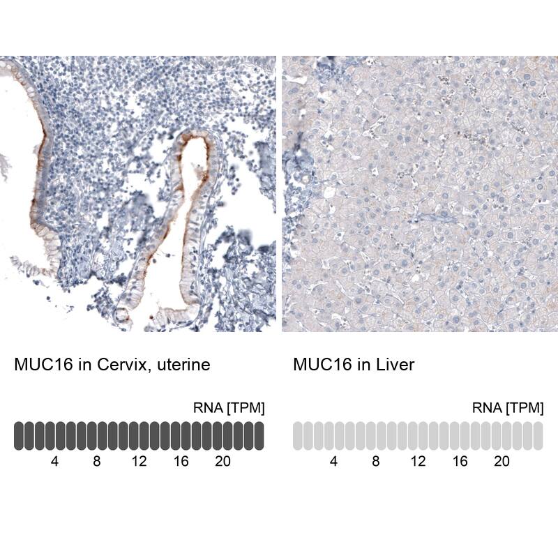Analysis in human cervix, uterine and liver tissues using NBP3-44100 antibody. Corresponding CA125/MUC16 RNA-seq data are presented for the same tissues.