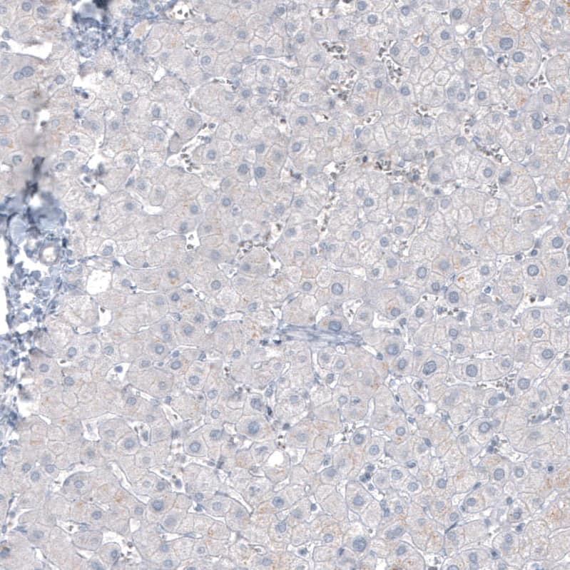 Staining of human liver shows no positivity in hepatocytes as expected.