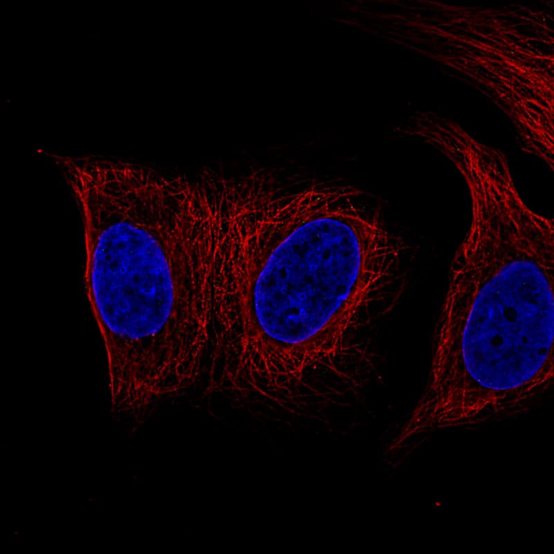 Staining of MCF7 cells using the Anti-Desmin monoclonal antibody) .