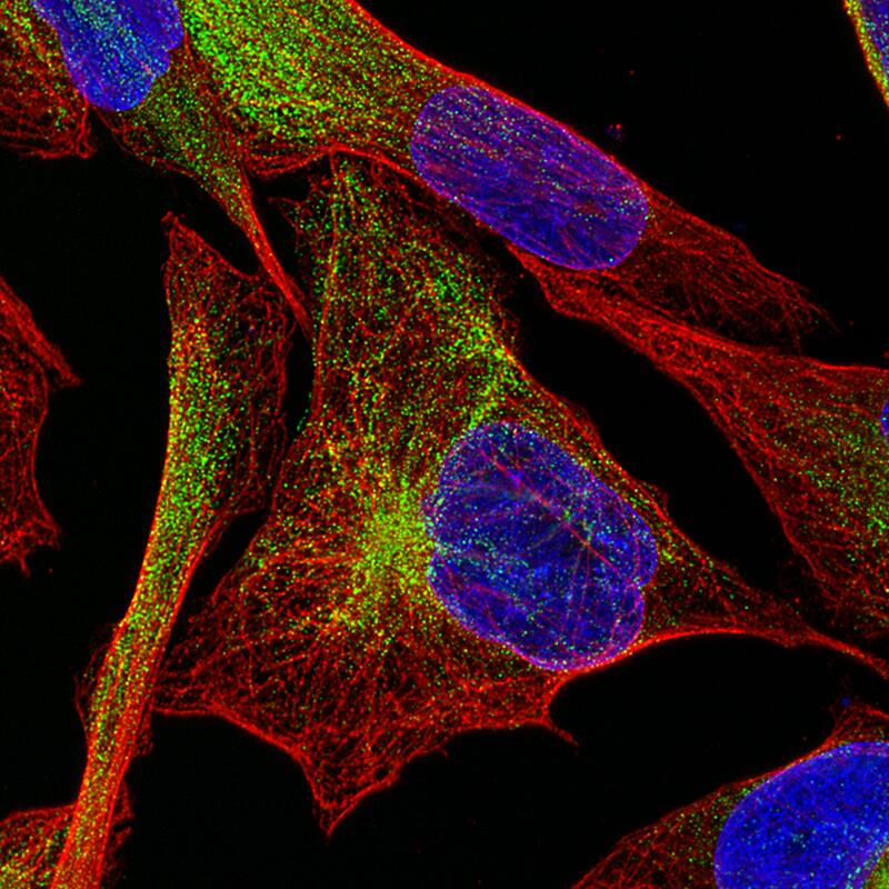 Staining of RH-30 cells using the Anti-Desmin monoclonal antibody) .