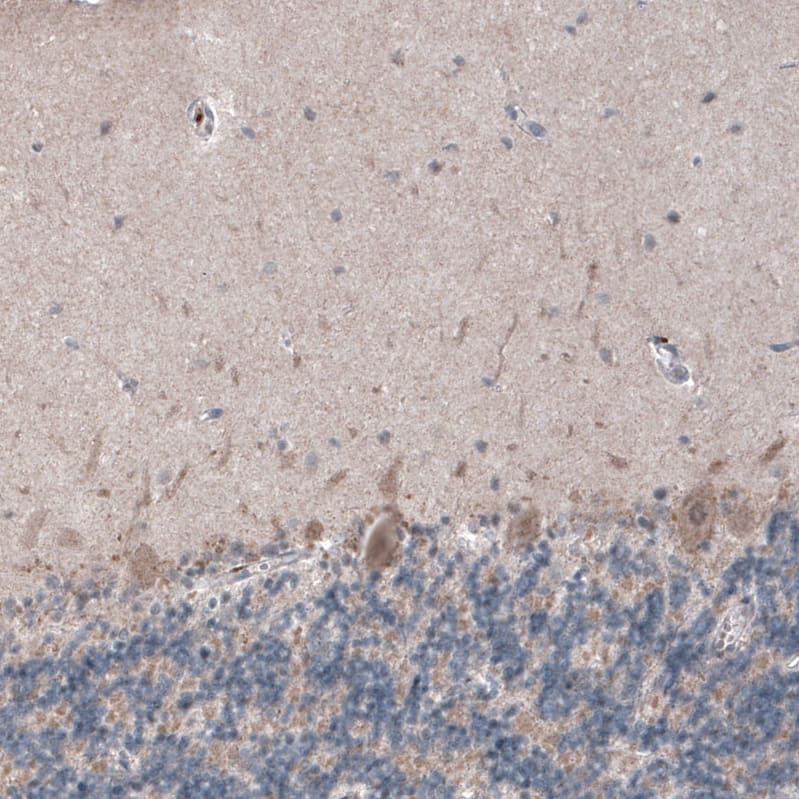 Staining of human cerebellum shows moderate cytoplasmic positivity in Purkinje cells.