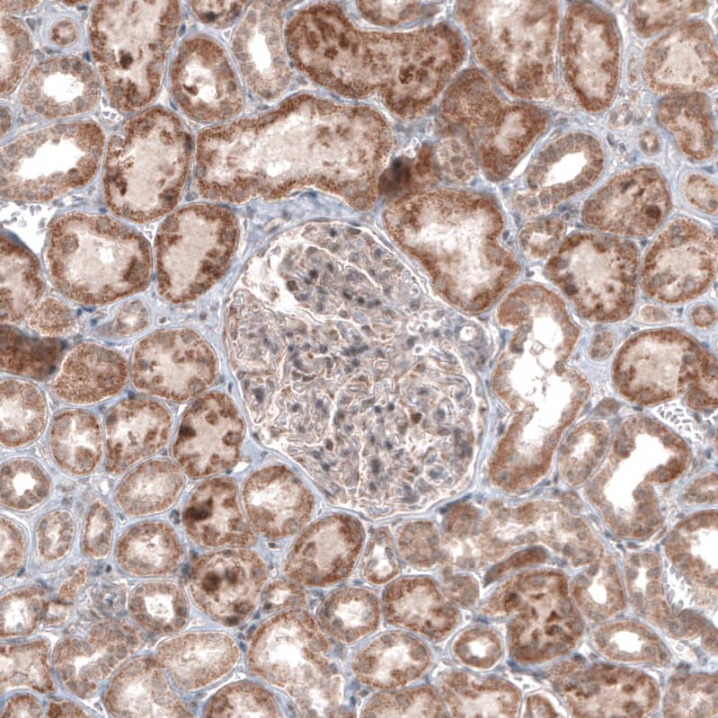 Staining of human kidney shows moderate cytoplasmic positivity in cells in tubules.