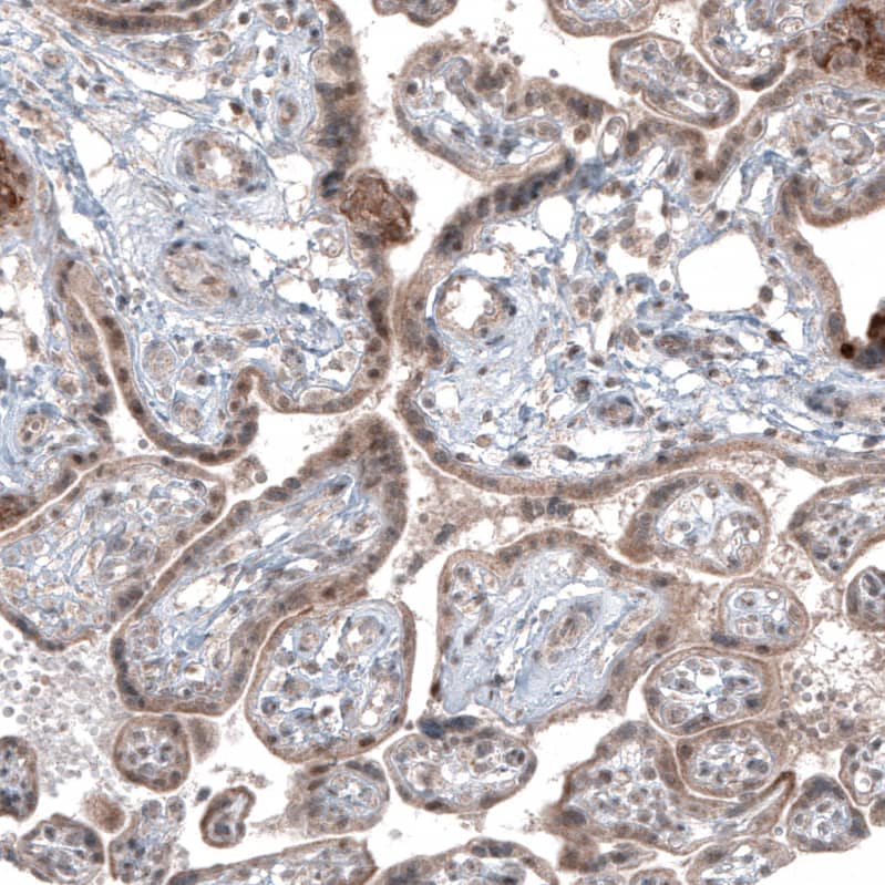 Staining of human placenta shows moderate cytoplasmic positivity in trophoblastic cells.
