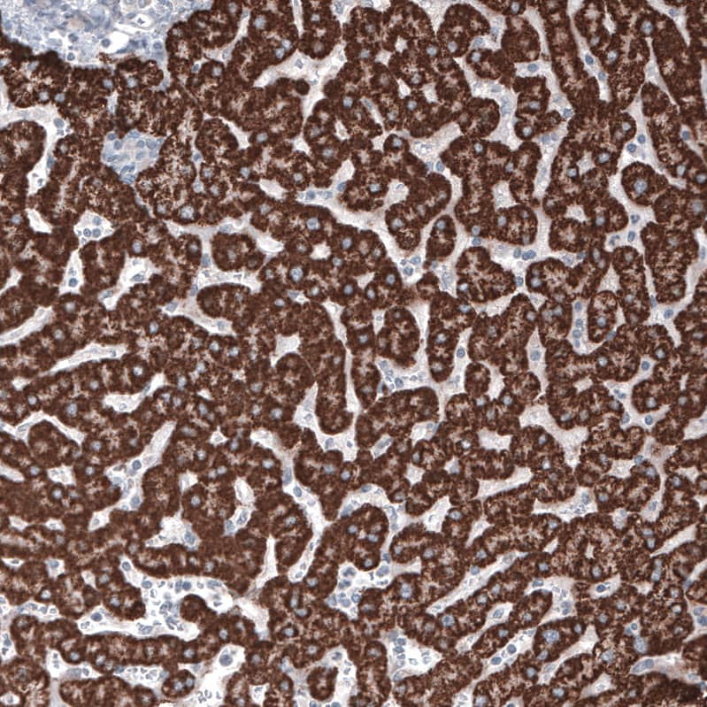 Staining of human liver shows strong granular cytoplasmic positivity in hepatocytes.