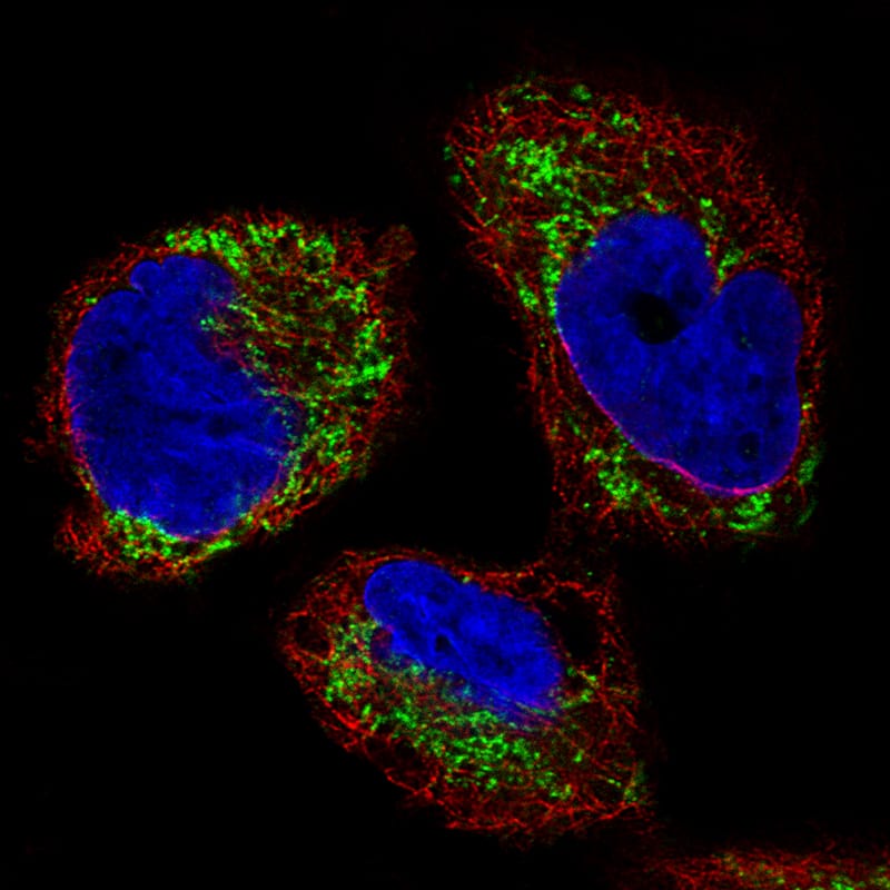 Staining of RH-30 cells using the Anti-Ornithine Carbamoyltransferase monoclonal antibody) .