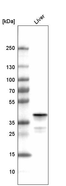 Analysis in human liver tissue.