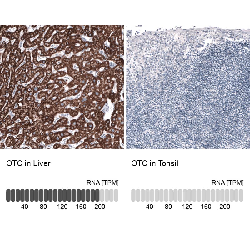 Analysis in human liver and tonsil tissues using NBP3-44106 antibody. Corresponding Ornithine Carbamoyltransferase RNA-seq data are presented for the same tissues.