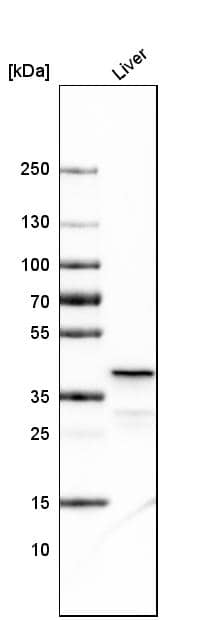 Analysis in human liver tissue.