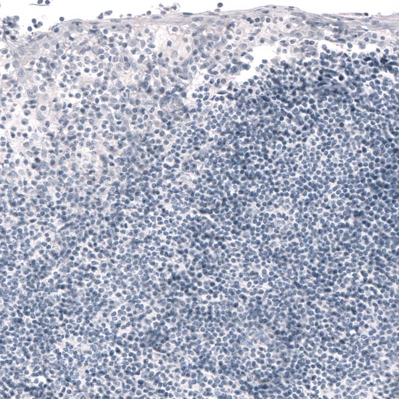 Staining of human tonsil shows no positivity in non-germinal center cells as expected.