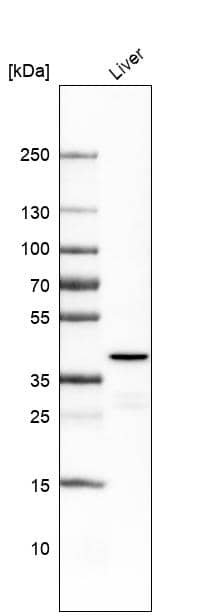 Analysis in human liver tissue.