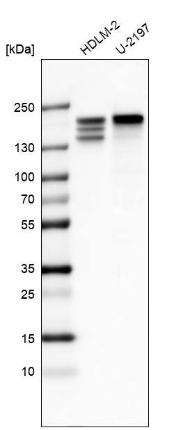 Analysis in human cell line HDLM-2 and human cell line U-2197.