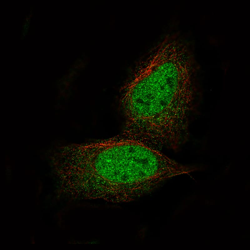 Staining of U-2 OS cells using the Anti-PRAME monoclonal antibody) .